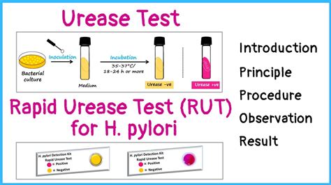 Urease Test: Principle, Procedure, Results • Microbe .